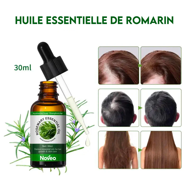 Huile de Romarin Noveo® (Pousse Extrême)